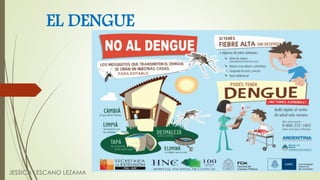 EL DENGUE
JESSICA LESCANO LEZAMA
 
