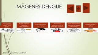 IMÁGENES DENGUE
JESSICA LESCANO LEZAMA
Fiebre súbita
mayor a 38
grados
Fuerte dolor de
huesos y
articulaciones
Dolor de cabeza
muy intenso
Manchas y
erupciones en la
piel y en el pecho
Dolor detrás de los
ojos que empeora
al moverse
Diarrea nauseas y
vomito
 