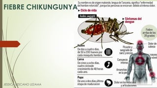 FIEBRE CHIKUNGUNYA
JESSICA LESCANO LEZAMA
 