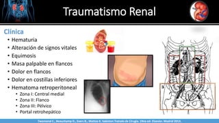 Traumatismo Renal
Sabinston
Clínica
• Hematuria
• Alteración de signos vitales
• Equimosis
• Masa palpable en flancos
• Dolor en flancos
• Dolor en costillas inferiores
• Hematoma retroperitoneal
• Zona I: Central medial
• Zona II: Flanco
• Zona III: Pélvico
• Portal retrohepático
Twonsend C., Beauchamp D., Evers B., Mattox K. Sabiston Tratado de Cirugía. 19na ed. Elsevier. Madrid 2013.
 