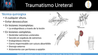 Traumatismo Ureteral
Sabinston
Técnica quirúrgica
• A cualquier altura.
• Evitar desvasculizar.
• En lesiones incompletas:
• La endoprótesis a través de la lesión
• En lesiones completas.
• Desbridar extremos ureterales
• Sección en espátula de extremos
• Endoprótesis interna
• Cierre impermeable con sutura absorbible
• Drenaje externo
• Aislamiento con peritoneo o epiplón
Twonsend C., Beauchamp D., Evers B., Mattox K. Sabiston Tratado de Cirugía. 19na ed. Elsevier. Madrid 2013.
 