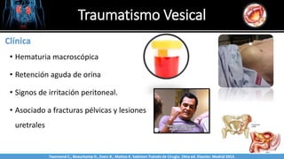 Traumatismo Vesical
Sabinston
Clínica
• Hematuria macroscópica
• Retención aguda de orina
• Signos de irritación peritoneal.
• Asociado a fracturas pélvicas y lesiones
uretrales
Twonsend C., Beauchamp D., Evers B., Mattox K. Sabiston Tratado de Cirugía. 19na ed. Elsevier. Madrid 2013.
 