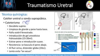 Traumatismo Uretral
Sabinston
Técnica quirúrgica:
Catéter uretral o sonda suprapúbica.
• Cateterismo
• Decúbito supino.
• Limpieza de glande y pene hasta base.
• Paño estéril fenestrado.
• Introducción de gel anestésico
hidrosoluble (15-20ml).
• Estirar pene e introducción suave.
• Resistencia: se bascula el pene abajo.
• Al fluir orina, distender globo (10cc).
• Lento evita “ex vacuo”.
Twonsend C., Beauchamp D., Evers B., Mattox K. Sabiston Tratado de Cirugía. 19na ed. Elsevier. Madrid 2013.
 