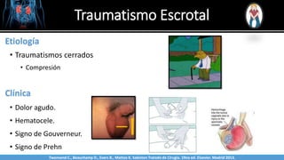 Traumatismo Escrotal
Sabinston
Etiología
• Traumatismos cerrados
• Compresión
Clínica
• Dolor agudo.
• Hematocele.
• Signo de Gouverneur.
• Signo de Prehn
Twonsend C., Beauchamp D., Evers B., Mattox K. Sabiston Tratado de Cirugía. 19na ed. Elsevier. Madrid 2013.
 