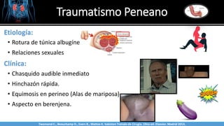 Traumatismo Peneano
Sabinston
Etiología:
• Rotura de túnica albugínea
• Relaciones sexuales
Clínica:
• Chasquido audible inmediato
• Hinchazón rápida.
• Equimosis en perineo (Alas de mariposa).
• Aspecto en berenjena.
Twonsend C., Beauchamp D., Evers B., Mattox K. Sabiston Tratado de Cirugía. 19na ed. Elsevier. Madrid 2013.
 