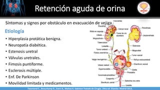 Retención aguda de orina
Sabinston
Etiología
• Hiperplasia protática benigna.
• Neuropatía diabética.
• Estenosis uretral
• Válvulas uretrales.
• Fimosis puntiforme.
• Esclerosis múltiple.
• Enf. De Parkinson
• Movilidad limitada y medicamentos.
Síntomas y signos por obstáculo en evacuación de vejiga
Twonsend C., Beauchamp D., Evers B., Mattox K. Sabiston Tratado de Cirugía. 19na ed. Elsevier. Madrid 2013.
 
