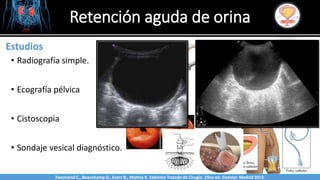 Sabinston
Estudios
• Radiografía simple.
• Ecografía pélvica
• Cistoscopia
• Sondaje vesical diagnóstico.
Retención aguda de orina
Twonsend C., Beauchamp D., Evers B., Mattox K. Sabiston Tratado de Cirugía. 19na ed. Elsevier. Madrid 2013.
 