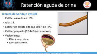 Sabinston
Técnica de Sondaje Vesical
• Catéter curvado en HPB.
• A las 12.
• Catéter de calibre alto (18-20 Fr) en HPB.
• Catéter pequeño (12-14Fr) en estenosis
• Vaciamiento:
• 400cc y luego pinzar.
• 200cc cada 10 min.
Retención aguda de orina
Twonsend C., Beauchamp D., Evers B., Mattox K. Sabiston Tratado de Cirugía. 19na ed. Elsevier. Madrid 2013.
 