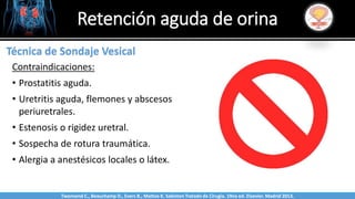 Sabinston
Técnica de Sondaje Vesical
Contraindicaciones:
• Prostatitis aguda.
• Uretritis aguda, flemones y abscesos
periuretrales.
• Estenosis o rigidez uretral.
• Sospecha de rotura traumática.
• Alergia a anestésicos locales o látex.
Retención aguda de orina
Twonsend C., Beauchamp D., Evers B., Mattox K. Sabiston Tratado de Cirugía. 19na ed. Elsevier. Madrid 2013.
 