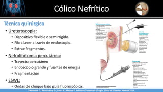 Cólico Nefrítico
Sabinston
Técnica quirúrgica
• Ureteroscopia:
• Dispositivo flexible o semirrígido.
• Fibra laser a través de endoscopio.
• Extrae fragmentos.
• Nefrolitotomía percutánea:
• Trayecto percutáneo
• Endoscopio grande y fuentes de energía
• Fragmentación
• ESWL:
• Ondas de choque bajo guía fluoroscópica.
Twonsend C., Beauchamp D., Evers B., Mattox K. Sabiston Tratado de Cirugía. 19na ed. Elsevier. Madrid 2013.
 