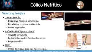 Cólico Nefrítico
Sabinston
Técnica quirúrgica
• Ureteroscopia:
• Dispositivo flexible o semirrígido.
• Fibra laser a través de endoscopio.
• Extrae fragmentos.
• Nefrolitotomía percutánea:
• Trayecto percutáneo
• Endoscopio grande y fuentes de energía
• Fragmentación
• ESWL:
• Ondas de choque bajo guía fluoroscópica.
Twonsend C., Beauchamp D., Evers B., Mattox K. Sabiston Tratado de Cirugía. 19na ed. Elsevier. Madrid 2013.
 