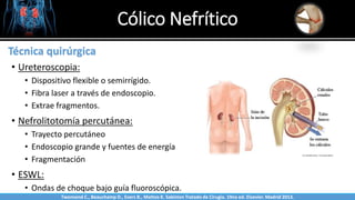 Cólico Nefrítico
Sabinston
Técnica quirúrgica
• Ureteroscopia:
• Dispositivo flexible o semirrígido.
• Fibra laser a través de endoscopio.
• Extrae fragmentos.
• Nefrolitotomía percutánea:
• Trayecto percutáneo
• Endoscopio grande y fuentes de energía
• Fragmentación
• ESWL:
• Ondas de choque bajo guía fluoroscópica.
Twonsend C., Beauchamp D., Evers B., Mattox K. Sabiston Tratado de Cirugía. 19na ed. Elsevier. Madrid 2013.
 