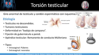 Torsión testicular
Twonsend C., Beauchamp D., Evers B., Mattox K. Sabiston Tratado de Cirugía. 19na ed. Elsevier. Madrid 2013.
Etiología
• Testículos no descendidos.
• Tumores testiculares
• Deformidad en “badajo de campana”.
• Fijación de gubernáculo a pared.
• Apéndice testicular: Remanente de conducto Mülleriano.
• Tipos:
• Intravaginal: Púberes
• Extravaginal: neonatos
Giro anormal de testículo y cordón espermático con isquemia.
Twonsend C., Beauchamp D., Evers B., Mattox K. Sabiston Tratado de Cirugía. 19na ed. Elsevier. Madrid 2013.
 