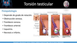 Torsión testicular
Sabinston
Fisiopatología
• Depende de grado de rotación.
• Obstrucción venosa.
• Trombosis venosa.
• Trombosis arterial.
• Isquemia.
• Necrosis e infarto.
Twonsend C., Beauchamp D., Evers B., Mattox K. Sabiston Tratado de Cirugía. 19na ed. Elsevier. Madrid 2013.
 