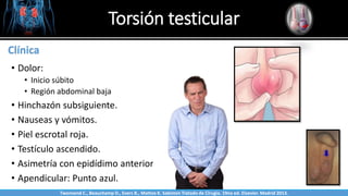 Torsión testicular
Sabinston
Clínica
• Dolor:
• Inicio súbito
• Región abdominal baja
• Hinchazón subsiguiente.
• Nauseas y vómitos.
• Piel escrotal roja.
• Testículo ascendido.
• Asimetría con epidídimo anterior.
• Apendicular: Punto azul.
Twonsend C., Beauchamp D., Evers B., Mattox K. Sabiston Tratado de Cirugía. 19na ed. Elsevier. Madrid 2013.
 