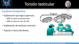 Torsión testicular
Sabinston
Conducta terapéutica
• Exploración quirúrgica oportuna.
• 80% se salva en primeras 6h.
• 20% se salva en mas de 12h.
• Exploración de testículo contrario.
• Fijación a fascia del dartos.
Twonsend C., Beauchamp D., Evers B., Mattox K. Sabiston Tratado de Cirugía. 19na ed. Elsevier. Madrid 2013.
 