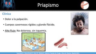 Priapismo
Sabinston
Clínica
• Dolor a la palpación.
• Cuerpos cavernosos rígidos y glande flácido.
• Alto flujo: No doloroso, sin isquemia.
Twonsend C., Beauchamp D., Evers B., Mattox K. Sabiston Tratado de Cirugía. 19na ed. Elsevier. Madrid 2013.
 