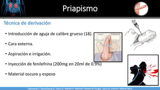 Priapismo
Sabinston
Técnica de derivación
• Introducción de aguja de calibre grueso (18).
• Cara externa.
• Aspiración e irrigación.
• Inyección de fenilefrina (200mg en 20ml de 0.9%)
• Material oscuro y espeso
Twonsend C., Beauchamp D., Evers B., Mattox K. Sabiston Tratado de Cirugía. 19na ed. Elsevier. Madrid 2013.
 