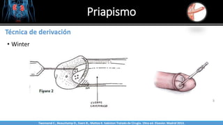 Priapismo
Sabinston
Técnica de derivación
• Winter
Twonsend C., Beauchamp D., Evers B., Mattox K. Sabiston Tratado de Cirugía. 19na ed. Elsevier. Madrid 2013.
 
