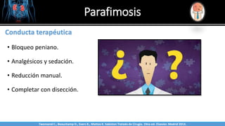 Parafimosis
Sabinston
Conducta terapéutica
• Bloqueo peniano.
• Analgésicos y sedación.
• Reducción manual.
• Completar con disección.
Twonsend C., Beauchamp D., Evers B., Mattox K. Sabiston Tratado de Cirugía. 19na ed. Elsevier. Madrid 2013.
 