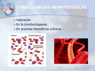 CONSECUENCIAS HEMATOLOGICAS
 Valoracion
 En la trombocitopenia
 En anemias hemolíticas crónicas
 
