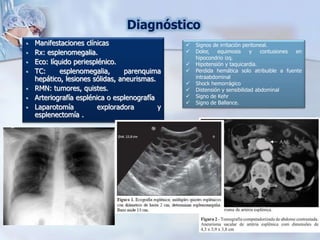  Signos de irritación peritoneal.
 Dolor, equimosis y contusiones en
hipocondrio izq.
 Hipotensión y taquicardia.
 Perdida hemática solo atribuible a fuente
intraabdominal
 Shock hemorrágico
 Distensión y sensibilidad abdominal
 Signo de Kehr
 Signo de Ballance.
Diagnóstico
 Manifestaciones clínicas
 Rx: esplenomegalia.
 Eco: líquido periesplénico.
 TC: esplenomegalia, parenquima
hepático, lesiones sólidas, aneurismas.
 RMN: tumores, quistes.
 Arteriografía esplénica o esplenografía
 Laparotomía exploradora y
esplenectomía .
 