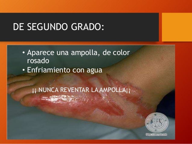 Emergencias y primeros auxilios Emergencias y primeros auxilios
