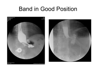 Band in Good Position 