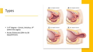 Types
• 1-4th degree – Cervix, introitus, 4th
within the vagina
• Acute /Subacute (24hr to 30
days)/Chronic
 