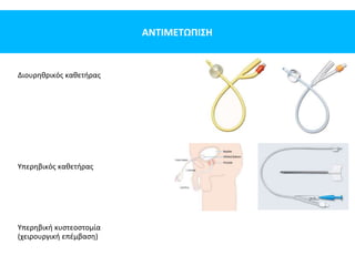 ΑΝΤΙΜΕΤΩΠΙΣΗ
Διουρηθρικός καθετήρας
Υπερηβικός καθετήρας
Υπερηβική κυστεοστομία
(χειρουργική επέμβαση)
 
