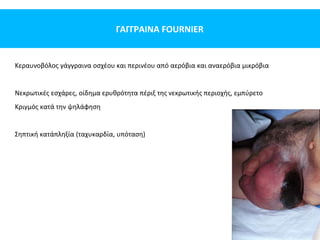 ΓΑΓΓΡΑΙΝΑ FOURNIER
Kεραυνοβόλος γάγγραινα οσχέου και περινέου από αερόβια και αναερόβια μικρόβια
Νεκρωτικές εσχάρες, οίδημα ερυθρότητα πέριξ της νεκρωτικής περιοχής, εμπύρετο
Κριγμός κατά την ψηλάφηση
Σηπτική κατάπληξία (ταχυκαρδία, υπόταση)
 