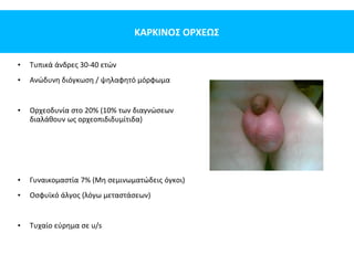 ΚΑΡΚΙΝΟΣ ΟΡΧΕΩΣ
• Τυπικά άνδρες 30-40 ετών
• Ανώδυνη διόγκωση / ψηλαφητό μόρφωμα
• Ορχεοδυνία στο 20% (10% των διαγνώσεων
διαλάθουν ως ορχεοπιδιδυμίτιδα)
• Γυναικομαστία 7% (Μη σεμινωματώδεις όγκοι)
• Οσφυϊκό άλγος (λόγω μεταστάσεων)
• Τυχαίο εύρημα σε u/s
 