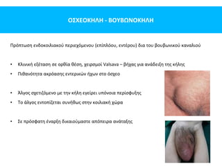 ΟΣΧΕΟΚΗΛΗ - ΒΟΥΒΩΝΟΚΗΛΗ
Πρόπτωση ενδοκοιλιακού περιεχόμενου (επίπλόου, εντέρου) δια του βουβωνικού καναλιού
• Κλινική εξέταση σε ορθία θέση, χειρσμοί Valsava – βήχας για ανάδειξη της κήλης
• Πιθανότητα ακρόασης εντερικών ήχων στο όσχεο
• Άλγος σχετιζόμενο με την κήλη εγείρει υπόνοια περίσφυξης
• Το άλγος εντοπίζεται συνήθως στην κοιλιακή χώρα
• Σε πρόσφατη έναρξη δικαιούμαστε απόπειρα ανάταξης
 
