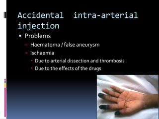 Emergencies in vascular surgery | PPTX
