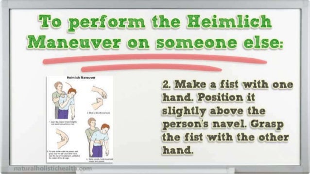 Emergency Medicine Choking The Heimlich Maneuver Emergency Medicine Choking The Heimlich Maneuver