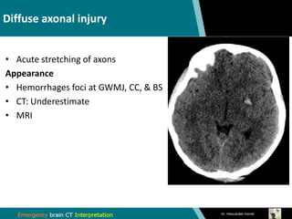 Emergency brain CT interpretation | PDF