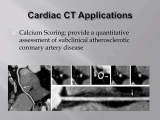  Calcium Scoring: provide a quantitative
assessment of subclinical atherosclerotic
coronary artery disease
 