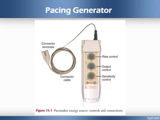 Pacing Generator
 