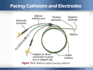 Pacing Catheters and Electrodes
 