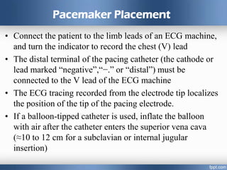 Pacemaker Placement
• Connect the patient to the limb leads of an ECG machine,
and turn the indicator to record the chest (V) lead
• The distal terminal of the pacing catheter (the cathode or
lead marked “negative”,“−.” or “distal”) must be
connected to the V lead of the ECG machine
• The ECG tracing recorded from the electrode tip localizes
the position of the tip of the pacing electrode.
• If a balloon-tipped catheter is used, inflate the balloon
with air after the catheter enters the superior vena cava
(≈10 to 12 cm for a subclavian or internal jugular
insertion)
 