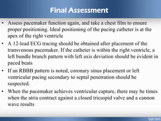 Final Assessment
• Assess pacemaker function again, and take a chest film to ensure
proper positioning. Ideal positioning of the pacing catheter is at the
apex of the right ventricle
• A 12-lead ECG tracing should be obtained after placement of the
transvenous pacemaker. If the catheter is within the right ventricle, a
left bundle branch pattern with left axis deviation should be evident in
paced beats
• If an RBBB pattern is noted, coronary sinus placement or left
ventricular pacing secondary to septal penetration should be
suspected.
• When the pacemaker achieves ventricular capture, there may be times
when the atria contract against a closed tricuspid valve and a cannon
wave results
 