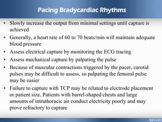 Pacing Bradycardiac Rhythms
• Slowly increase the output from minimal settings until capture is
achieved
• Generally, a heart rate of 60 to 70 beats/min will maintain adequate
blood pressure
• Assess electrical capture by monitoring the ECG tracing
• Assess mechanical capture by palpating the pulse
• Because of muscular contractions triggered by the pacer, carotid
pulses may be difficult to assess, so palpating the femoral pulse
may be easier
• Failure to capture with TCP may be related to electrode placement
or patient size. Patients with barrel-shaped chests and large
amounts of intrathoracic air conduct electricity poorly and may
prove refractory to capture
 