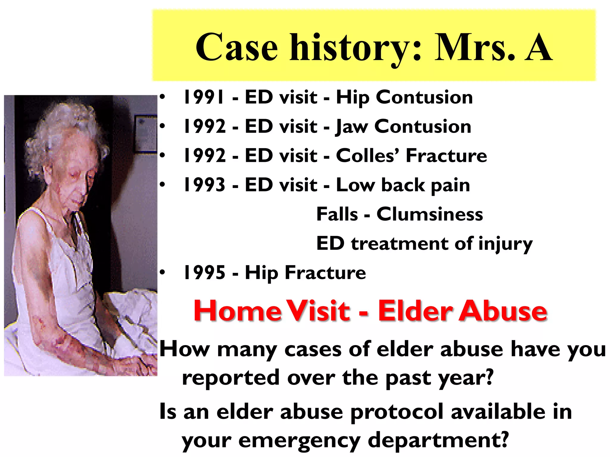 Case history: Mrs. A
• 1991 - ED visit - Hip Contusion
• 1992 - ED visit - Jaw Contusion
• 1992 - ED visit - Colles’ Fracture
• 1993 - ED visit - Low back pain
                 Falls - Clumsiness
                 ED treatment of injury
• 1995 - Hip Fracture

    Home Visit - Elder Abuse
How many cases of elder abuse have you
   reported over the past year?
Is an elder abuse protocol available in
   your emergency department?
 