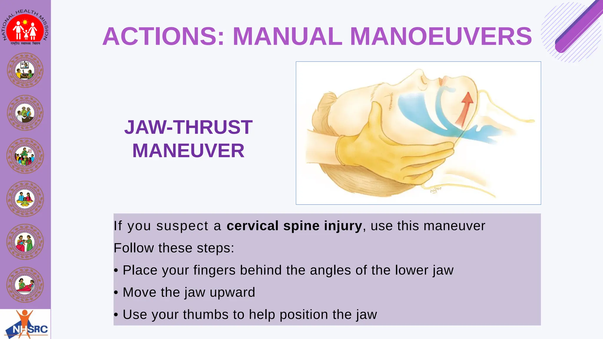 Emergency Care - Airway Management Principles | PDF