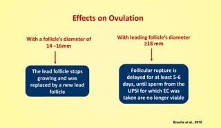 Effects on Ovulation
With a follicle’s diameter of
14 –16mm
The lead follicle stops
growing and was
replaced by a new lead
follicle
With leading follicle’s diameter
≥18 mm
Follicular rupture is
delayed for at least 5-6
days, until sperm from the
UPSI for which EC was
taken are no longer viable
Brache et al., 2010
 