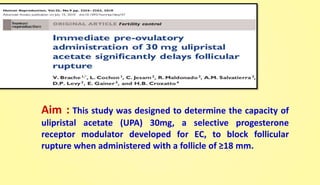 Aim : This study was designed to determine the capacity of
ulipristal acetate (UPA) 30mg, a selective progesterone
receptor modulator developed for EC, to block follicular
rupture when administered with a follicle of ≥18 mm.
 