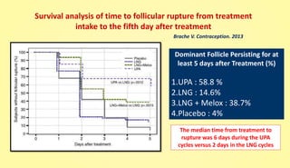 Survival analysis of time to follicular rupture from treatment
intake to the fifth day after treatment
Dominant Follicle Persisting for at
least 5 days after Treatment (%)
1.UPA : 58.8 %
2.LNG : 14.6%
3.LNG + Melox : 38.7%
4.Placebo : 4%
The median time from treatment to
rupture was 6 days during the UPA
cycles versus 2 days in the LNG cycles
Brache V. Contraception. 2013
 