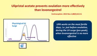 Ulipristal acetate prevents ovulation more effectively
than levonorgestrel
UPA
Contraception. 2013 Nov 1;88(5):611-8.
Physiological LH
Surge
UPA works on the most fertile
days, i.e. just before ovulation,
during the LH surge (pre-peak),
when levonorgestrel is no more
effective
 