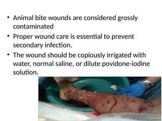 EMERGENCY DEPARTMENT MANAGEMENT OF DOG BITE.pptx