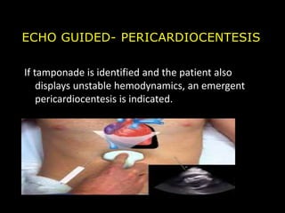 emergency echo in critically ill patients.ppt